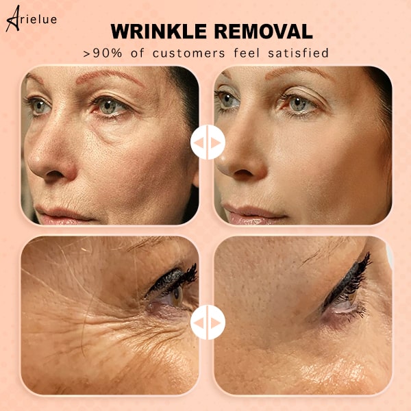 Arielue™ I Anti-Wrinkle Skin Rebounce Moisturizing Balm | 1+1 free