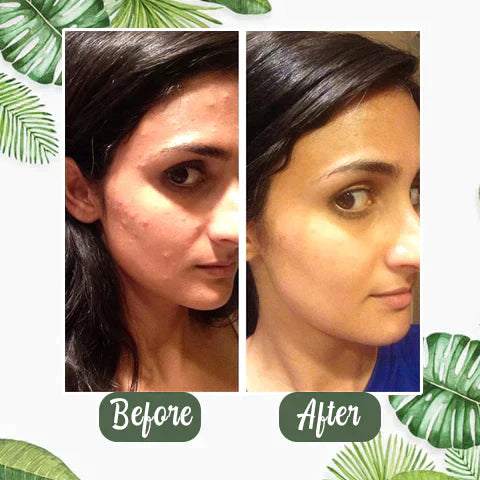 Mask® I Green Tea Deep Cleanse Mask