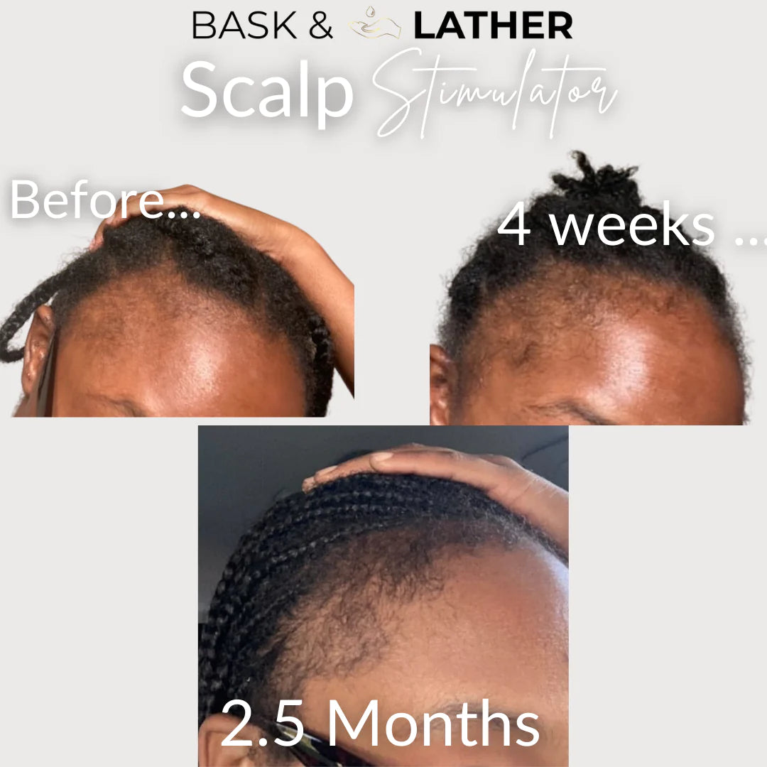 Jumbo Scalp Stimulator